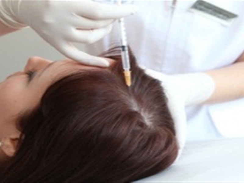 Hair Regrowth Injections - Explained