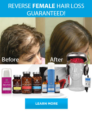 Female Hair Loss Treatment Product most Effective